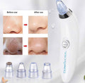 Blackhead Remover Vacuum