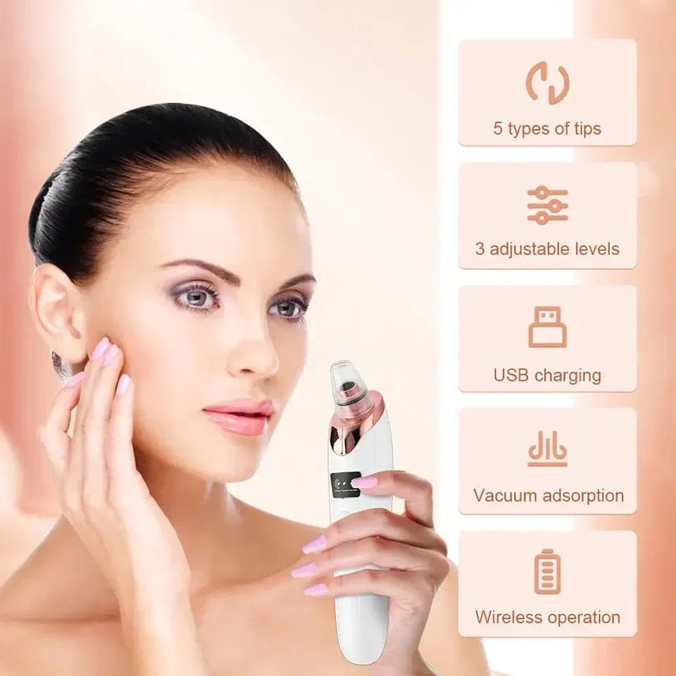 Electric Blackhead Remover Vacuum – Pore Cleaner & Acne Extractor Tool | 5 Suction Heads | Facial Skin Care Device