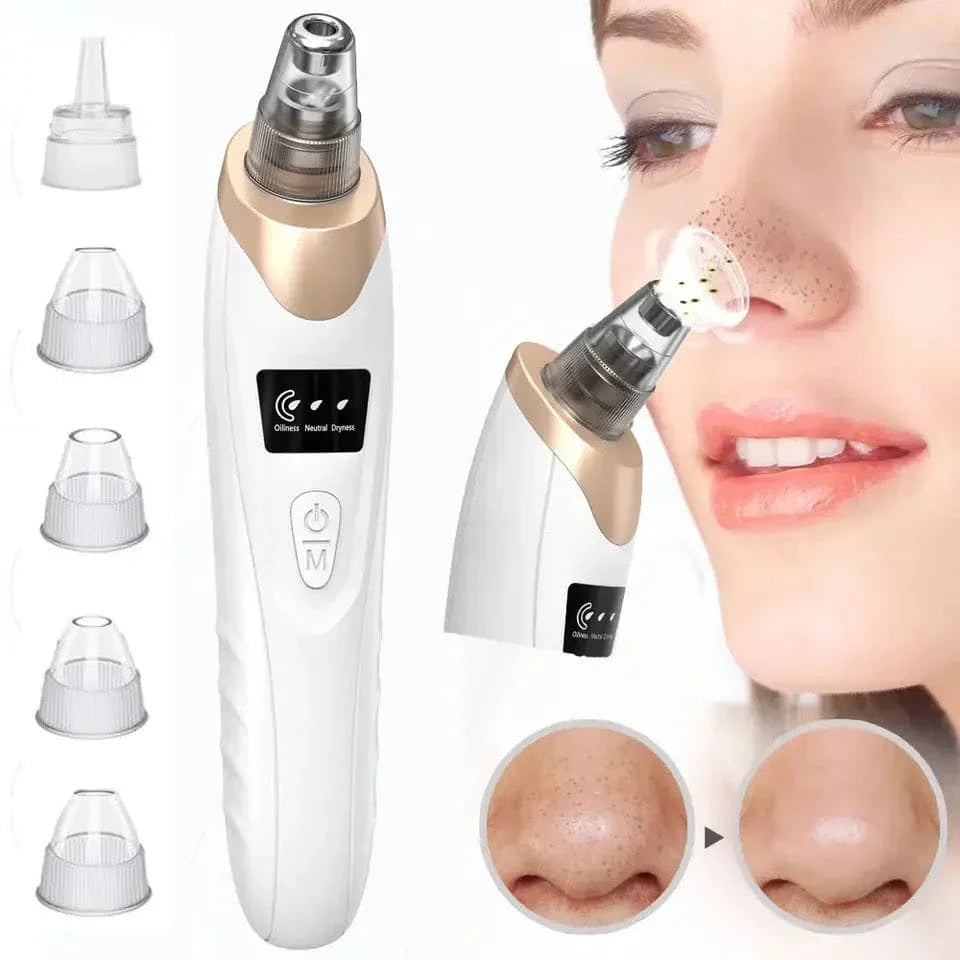 Electric Blackhead Remover Vacuum – Pore Cleaner & Acne Extractor Tool | 5 Suction Heads | Facial Skin Care Device